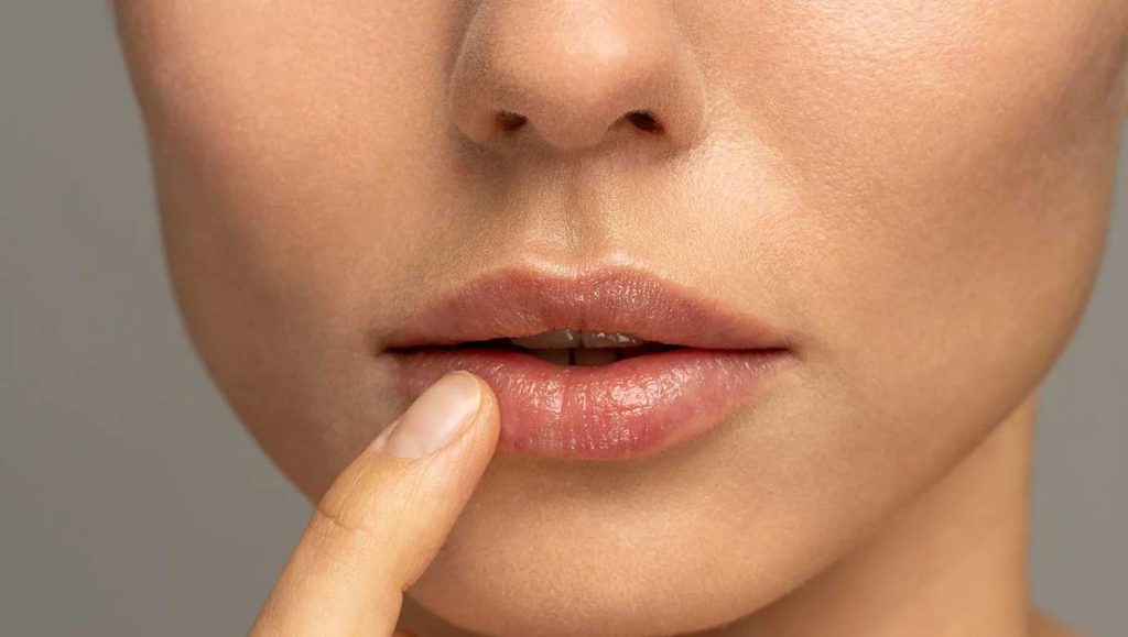 How to Treat a Cut Lip?